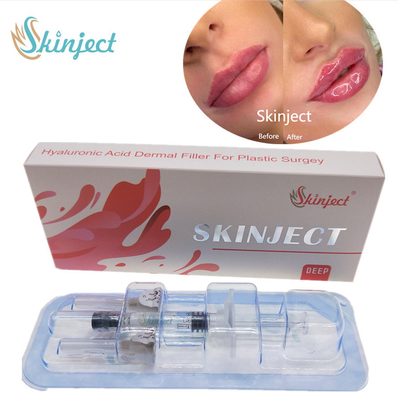 حقن Skinject Deep HA Dermal 2ml Lips Fillers Cheek Chin Nasolabial fold