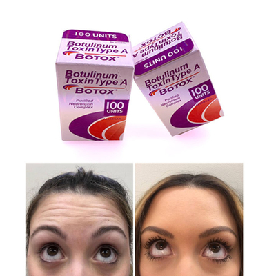 100 وحدة دولية Allergan  Botulinum Toxin النسخة الإنجليزية
