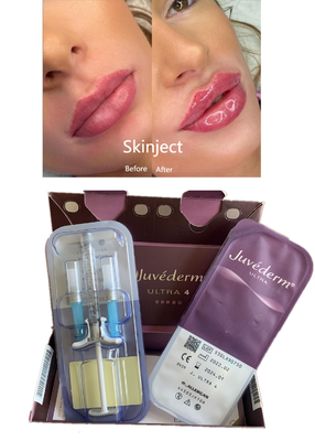 شفاه Reshape Juvederm Hyaluronic Acid Dermal Filler مع Lido Ultra4 2X1ml