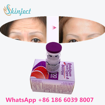 البوتولينوم توكسين البوتوكس لإزالة التجاعيد 100u Allergan 100 وحدة لحقن شد الوجه