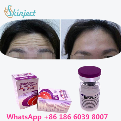البوتولينوم توكسين البوتوكس لإزالة التجاعيد 100u Allergan 100 وحدة لحقن شد الوجه