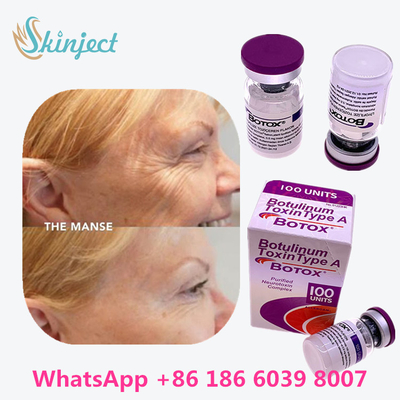 allergan botulinumoxin Anti Aging Products اكتب A Toxin Anti Wrinkle