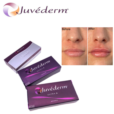 الحمض الهيلورونيكى ملء الجلد المميز Juvederm HA ملء الوجه Ultra3 Ultra4 Voluma لتجديد الوجه