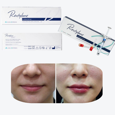 Juvederm Cross Linked Injectable Dermal Filler للشفاه
