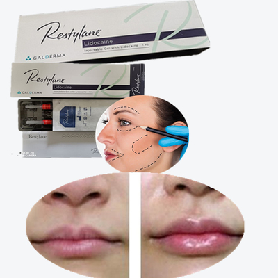 2*1ml/ Box Medical Sodium Hyaluronate Gel Filler Dermal للشفاه