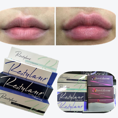 2*1ml/box حامض الهيالورونيك الحامض الجلدي لزيادة الشفاه