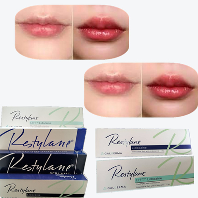 2*1ml/box حامض الهيالورونيك الحامض الجلدي لزيادة الشفاه