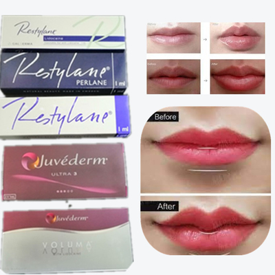 2*1ml/box حامض الهيالورونيك الحامض الجلدي لزيادة الشفاه