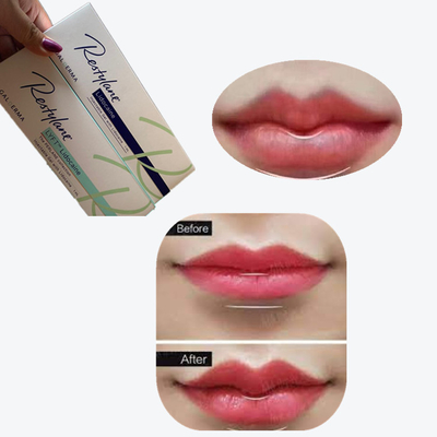 2*1ml/ Box Cross Linked Dermal Filler لزيادة الشفاه