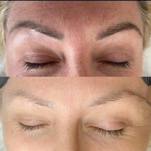 إزالة الحاجب إزالة الشعر ليزر آلة جمال 810nm ليزر إزالة الوشم