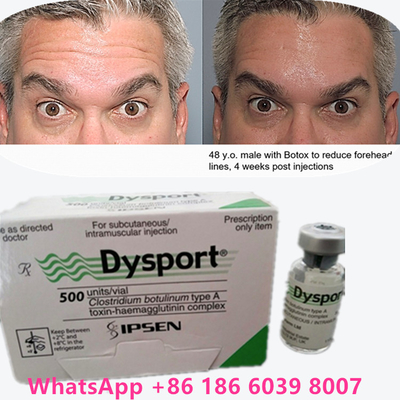 سم البوتولينوم 100 وحدة BTX الحقن النوع A استخدام التجميل