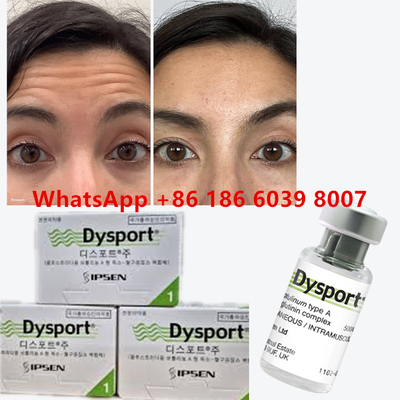 توكسين البوتولينوم Dysport 100u Clostridium Botulinum Type A للوجوه تجاعيد مضادة للشيخوخة