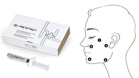 مدة طويلة 62mg 2ml حشوة جلدية قابلة للحقن Profhilo H+L Hyaluronate
