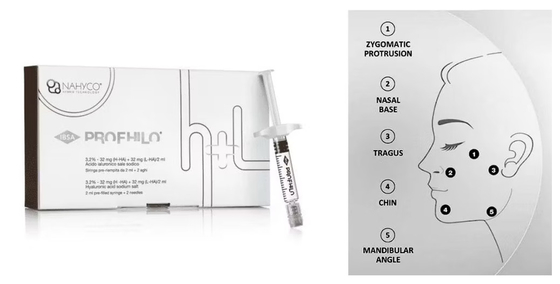 إبرة شد طبيعية المظهر ذات 5 نقاط لشد الوجه، فيلر جلدي قابل للحقن بروفايلو