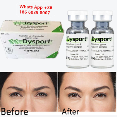 السم البوتولينيوم A Dysport Botox للحقن لزيادة الذقن