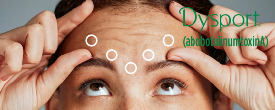 Dysport 500 للحقن AbobotulinumtoxinA بوتوكس 500U