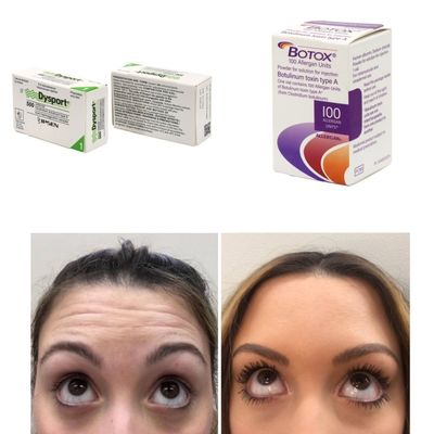 100 وحدة كوريا BTX سم البوتولينوم للتجاعيد والخطوط الدقيقة