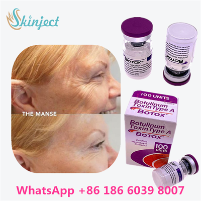 توكسين البوتولينوم بوتوكس التجميلي 100 وحدة أليرجان أونابوتولينوم توكسين أ للتجاعيد الوجهية