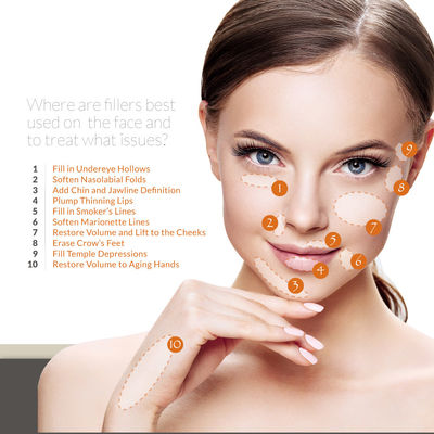 Skinject حمض الهيالورونيك جل حشو حقن تجاعيد الجبين إزالة