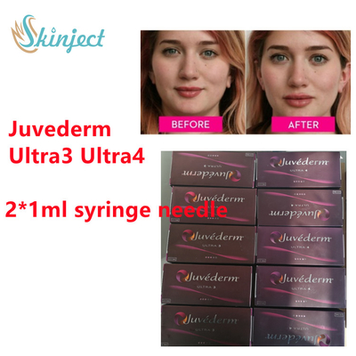 حشو الشفاه Juvederm Hyaluronic Acid Dermal Filler Juvederm Lip Filler مع  2x1ml Ultra3 Ultra4