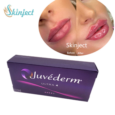Juvederm 2 * 1ml Lips Filler حمض الهيالورونيك حشو جلدي مع Lido Ultra4