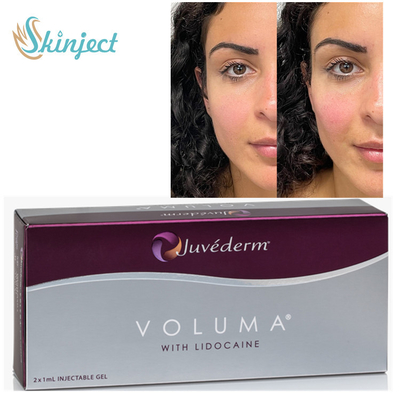 Juvederm Voluma 2x1ml حشو حمض الهيالورونيك الجلدي لعظم الخد