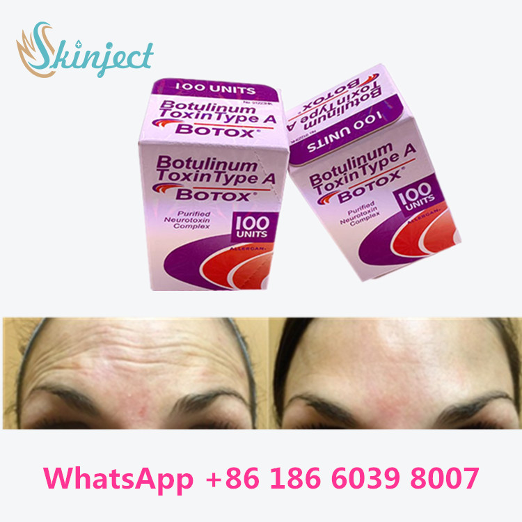 allergan botulinumoxin Anti Aging Products اكتب A Toxin Anti Wrinkle
