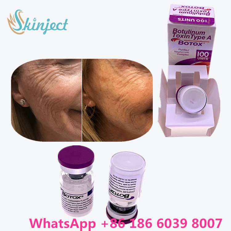 Allergan  Botulinum Toxin النوع A لمنتجات مكافحة الشيخوخة للبشرة