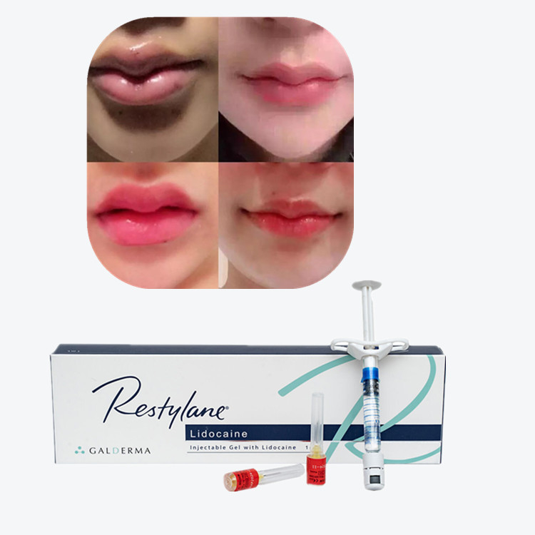 Juvederm Cross Linked Injectable Dermal Filler للشفاه