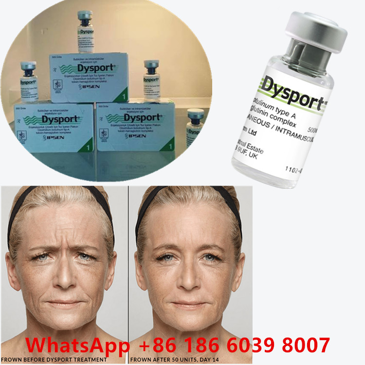 سم البوتولينوم 100 وحدة BTX الحقن النوع A استخدام التجميل