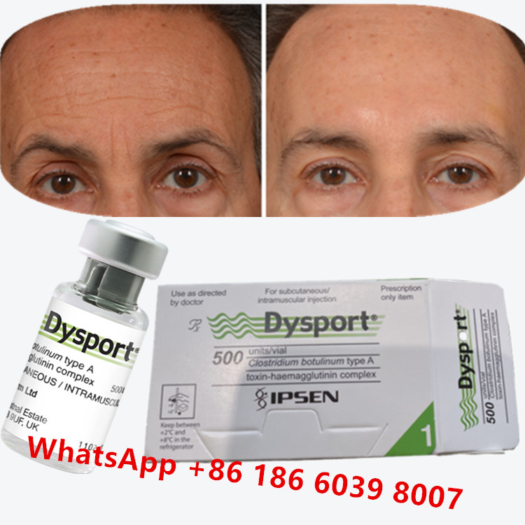سم البوتولينوم Dysport Clostridium Botulinum Type A لأقدام الغراب