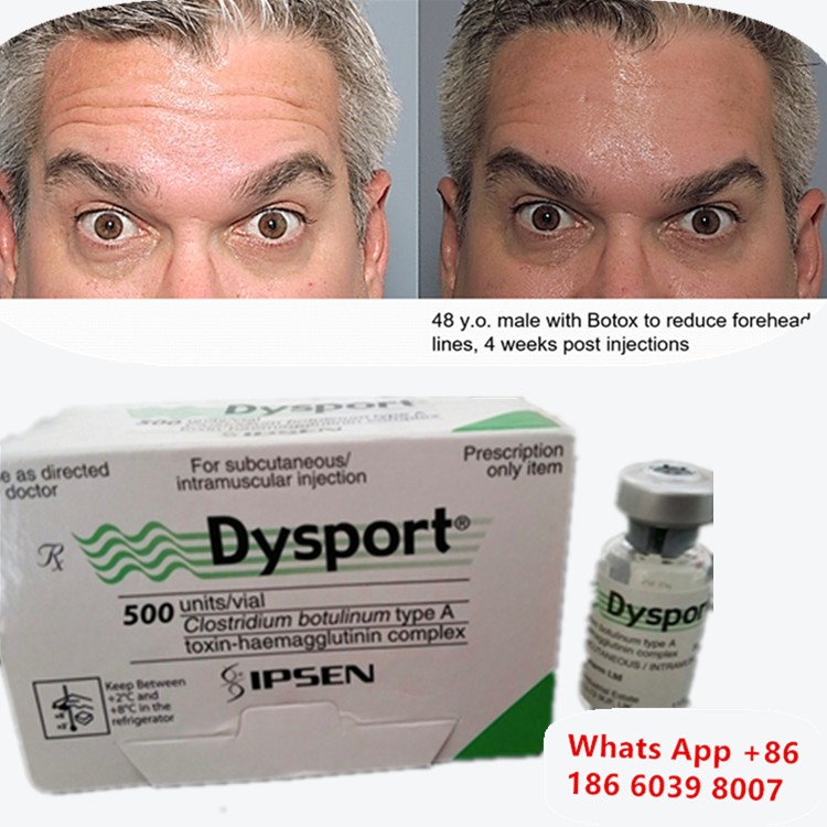 سم البوتولينوم Dysport Botox Clostridium Botulinum Type A لرفع الحاجب