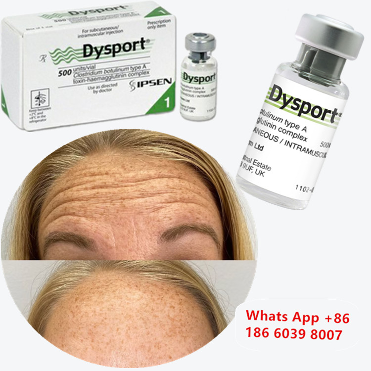 سم البوتولينوم Dysport Clostridium Botulinum Type A للذقن المتجمد