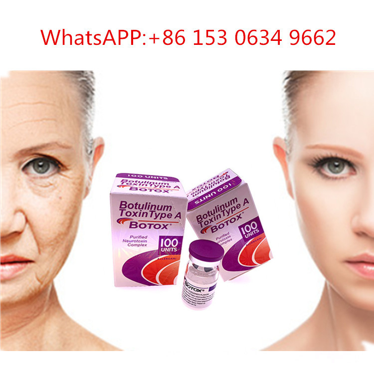 50u 100u 150u من النوع A حقن البوتوكس Allergan Botulinum Toxin لمكافحة التجاعيد