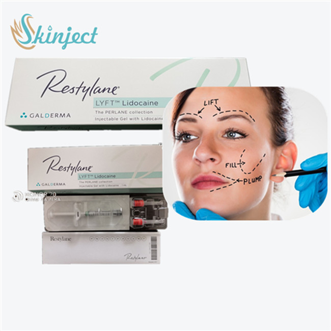 Hyaluronidase Solution   HA Dermal Fillers For Crow's Feet