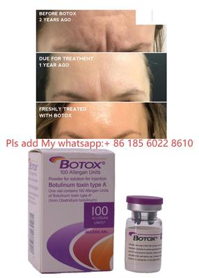 حقن Allergan Botox، بوتولاكس، توكسين البوتولينوم، إزالة التجاعيد